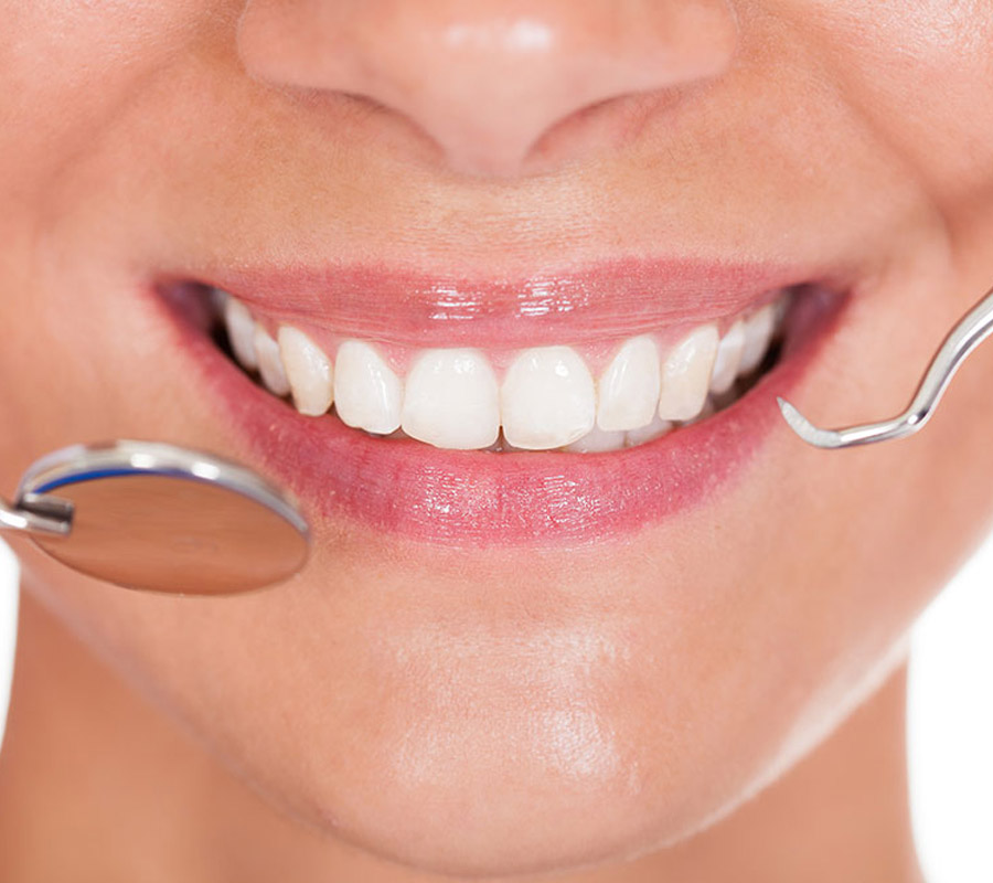 invisalign